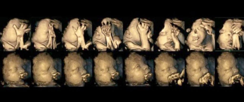 Ultraschall zeigt: So leiden die Babys von Raucher-Müttern!
