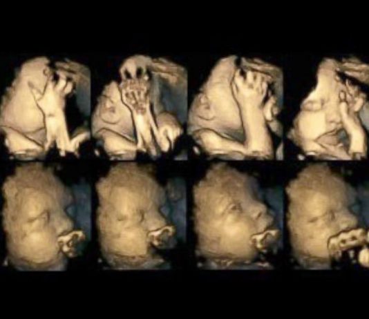 Rauchen in der Schwangerschaft: Ultraschallbild