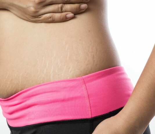 Die Yoga-Lehrerin Sabrina Ewer hat nach 19 Jahren ihren Post-Baby-Bauch lieben gelernt. – "Es geht auch anders!"