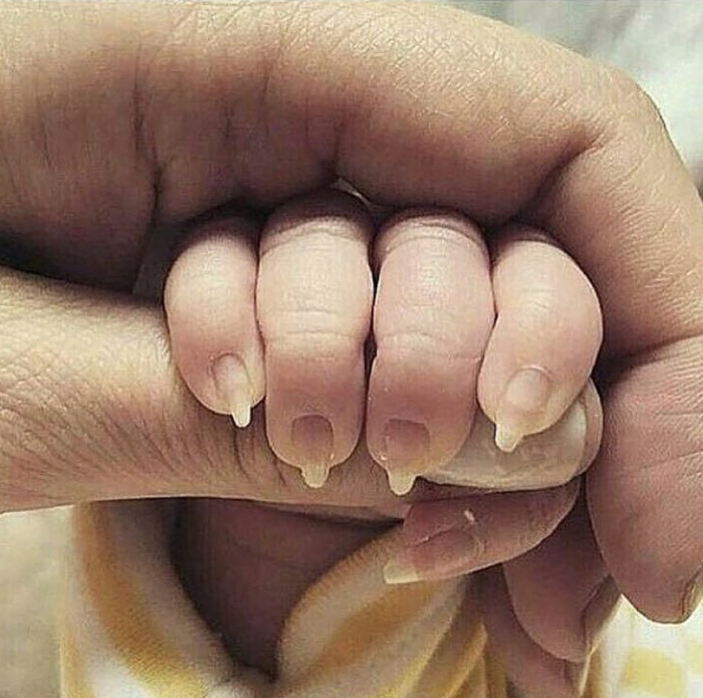 Krass, oder? Wie lange dürfen Fingernägel bei Babys sein?