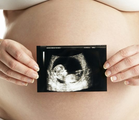 Schwangere mit Ultraschallbild aus dem Ersttrimesterscreening