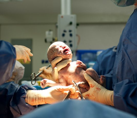 Baby beim Kaiserschnitt