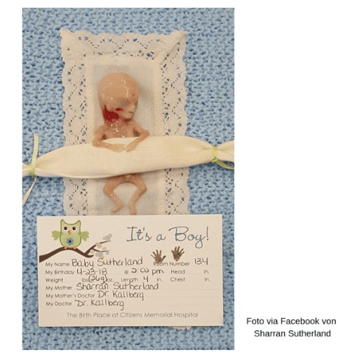 Baby in der 14. Schwangerschaftswoche