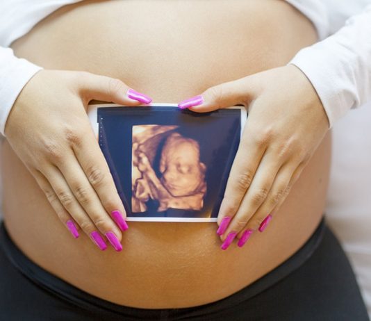 Schwangere zeigt 3-D-Ultraschall-Bild