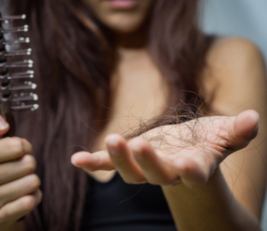 Frau mit Haarausfall