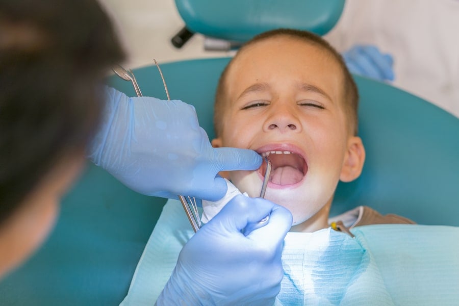 Kreidezähne: Immer mehr Kinder haben brüchige Zähne! Was tun?