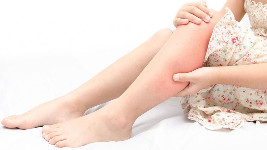 Wachstumsschmerzen beim Kind: Das hilft gegen brennende Beine