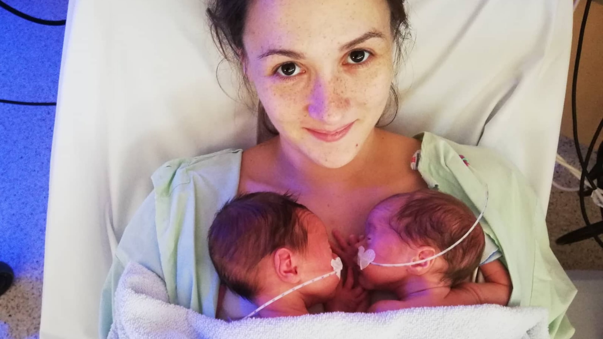 Darmverschluss In Der Schwangerschaft Zwillinge Uberstanden Not Op