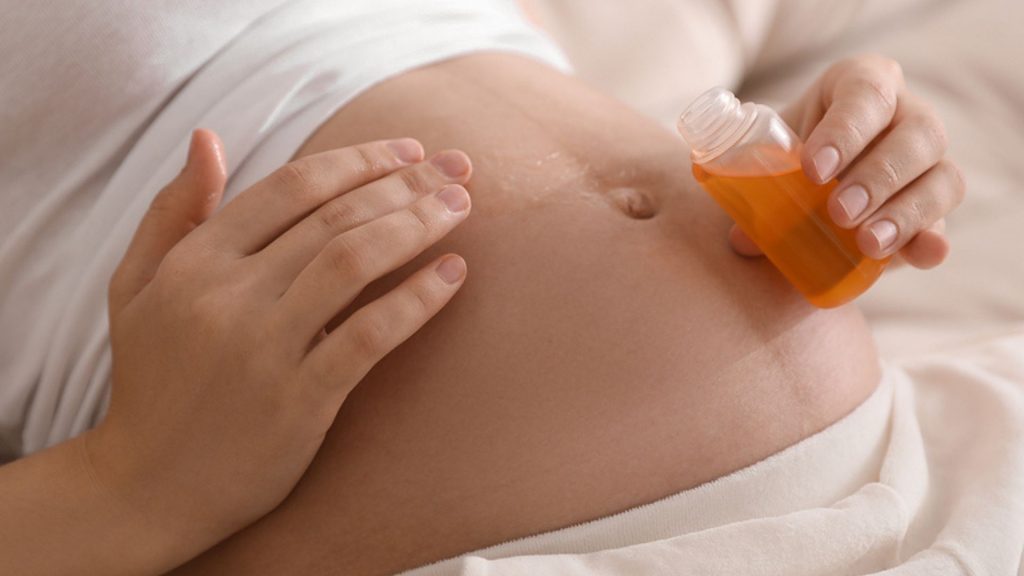 Schwangerschaftsöl: Welches Öl hilft gegen Schwangerschaftsstreifen
