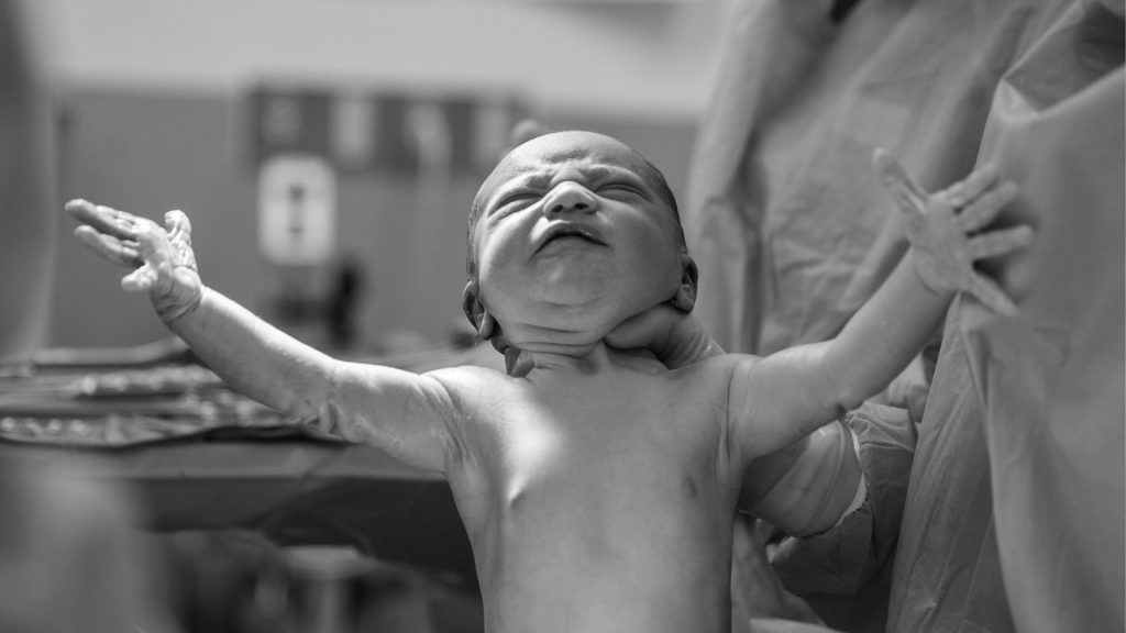 Was bedeutet ein Sternengucker Baby für die Geburt?
