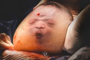 Baby Noah wird mit dem Kopf in der Fruchtblase geboren. Die Mitglieder der IAPBP wählten das Foto zum Sieger der Kategorie „Geburtsdetails“ bei den Geburtsfotos des Jahres
