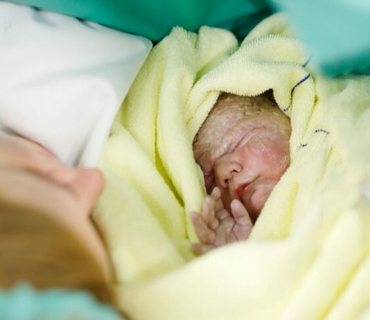 Es ist möglich, eine schmerzfreie Geburt zu erleben: neugebornes Baby