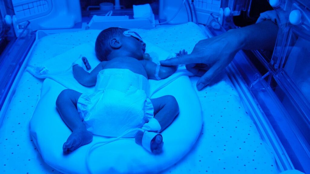 „Wir adoptierten ein Mikro-Frühchen – mit acht Tagen starb es.“