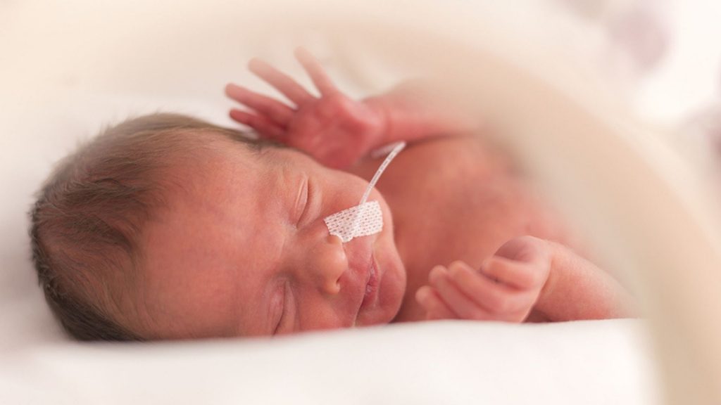 Zu früh geboren: Der aufreibende Start in das Leben meiner Tochter