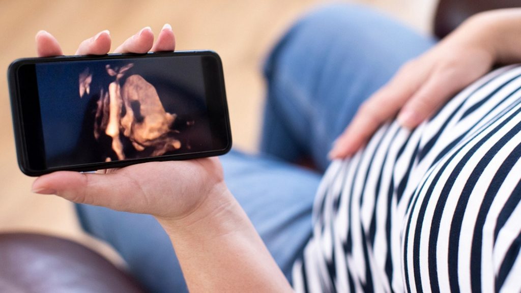 Sendeschluss bei „Baby-TV“: 3D-Ultraschall ab 2021 verboten