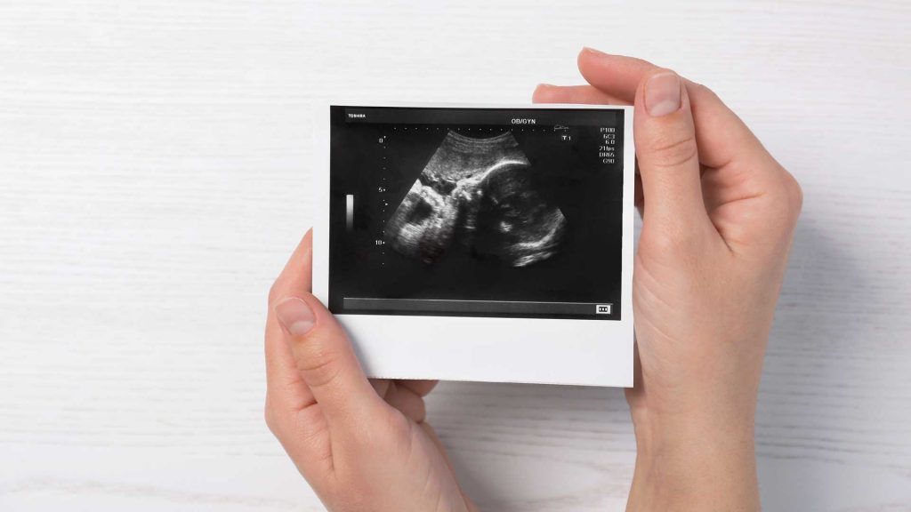Gebärmutterschleimhaut aufbauen: Tipps, die helfen!