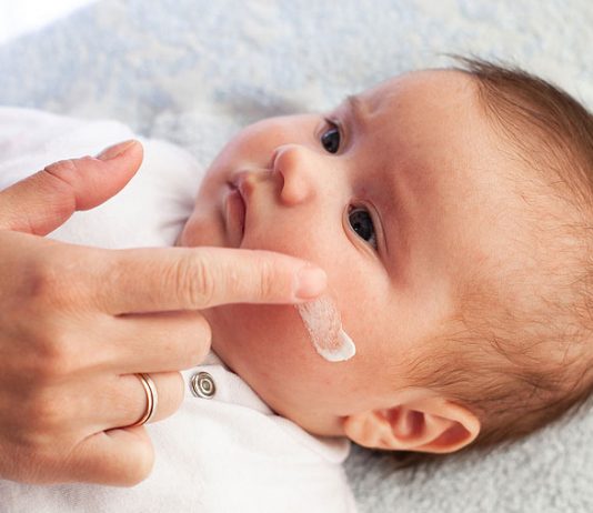 Bei Babys zeigt sich Neurodermitis meist im Gesicht, am Bauch oder Rücken.