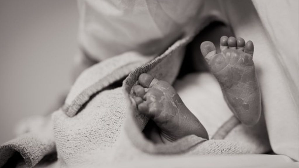 „Wie eine alte Frau”: Menschen im Netz verspotten Baby mit Gendefekt