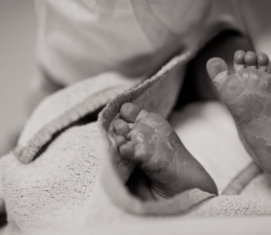 Ein Baby das mit einem seltenen Gendefekt zur Welt kam, wurde im Internet verspottet