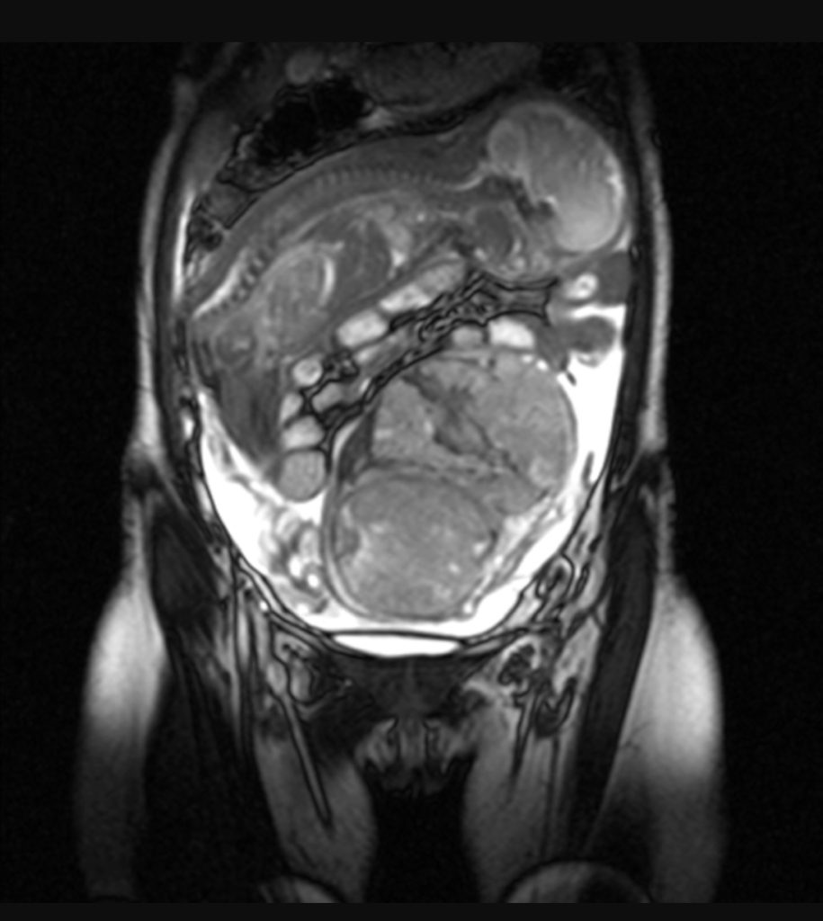 Динамическая кт сердца. Кт при беременности на ранних сроках. Кт при беременности на ранних сроках. Кт брюшной полости беременность. Магнитно-резонансная пельвиометрия.