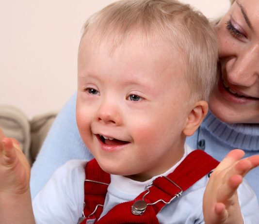 Die Adoptivmama eines Kindes mit Down-Syndrom möchte nicht „mutig” genannt werden.