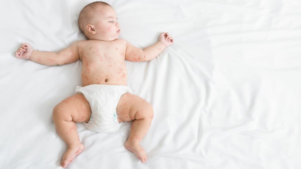 Facebook-Post rettet Baby: Mama erkennt trügerische Symptome