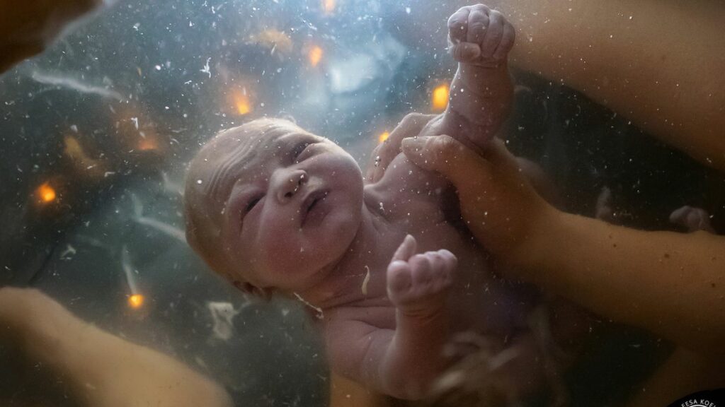 Die besten Geburtsfotos des Jahres 2025 – das sind die Gewinner!