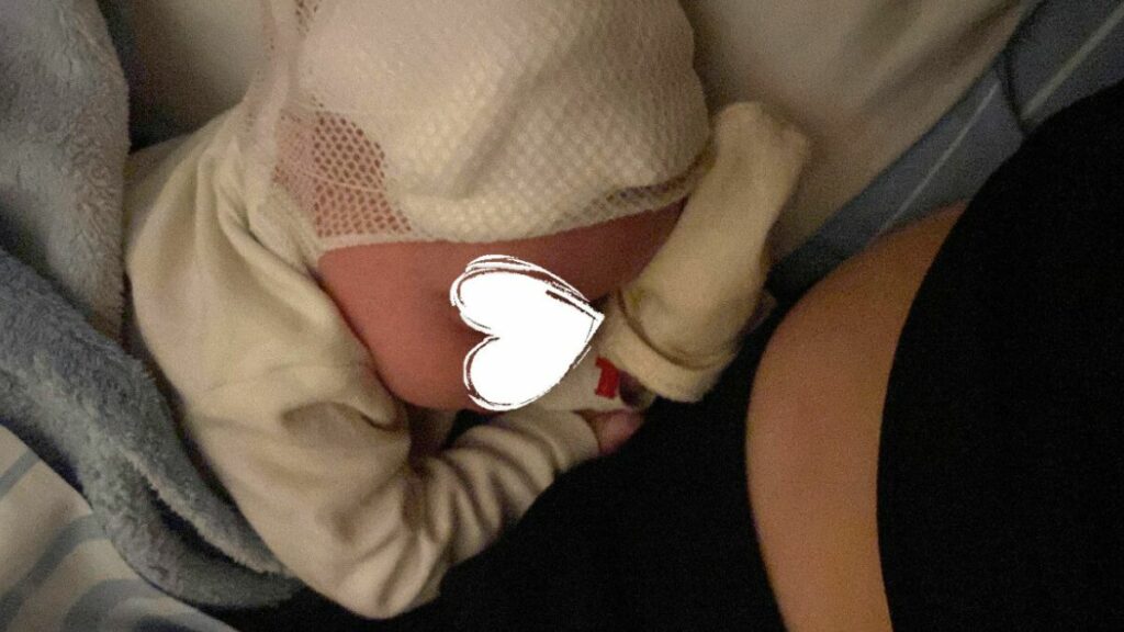 „Meine Tochter hat einen Wasserkopf und wir leben mit der Angst!“