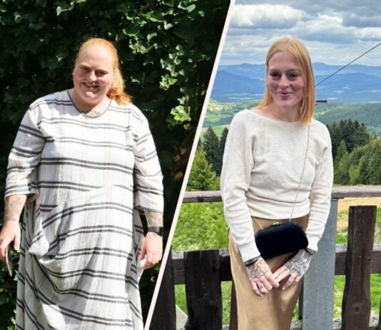 Seit ihrer Gewichtsabnahme lebt Anna ein neues Leben.