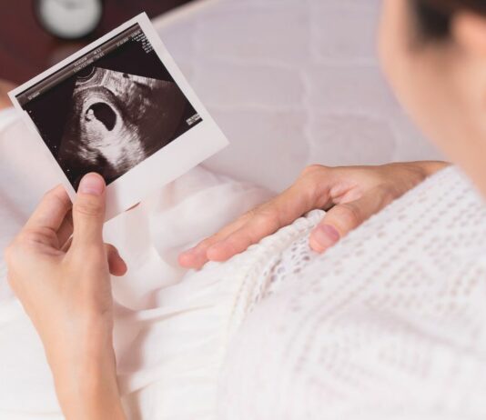 Als Miriam aus der Narkose für die Ausschabung aufwacht, erzählt ihr der Arzt, dass ihr Baby noch lebt.