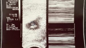 Auf dem Ultraschallbild, das der Arzt Miriam zeigte, waren deutlich das Baby und sein Herzschlag zu sehen.