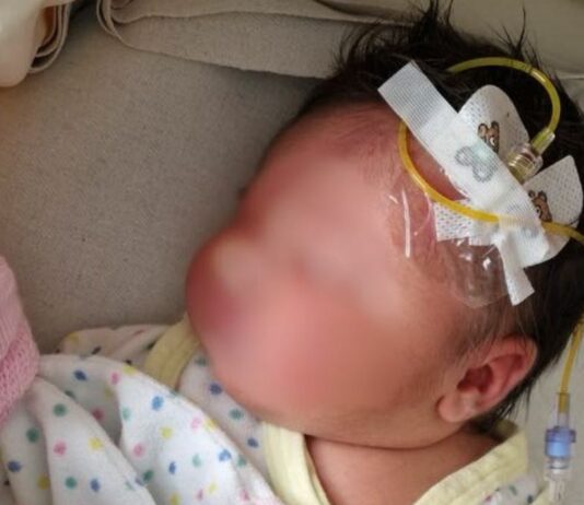 Nadjas kleine Tochter auf der Neonatologie.