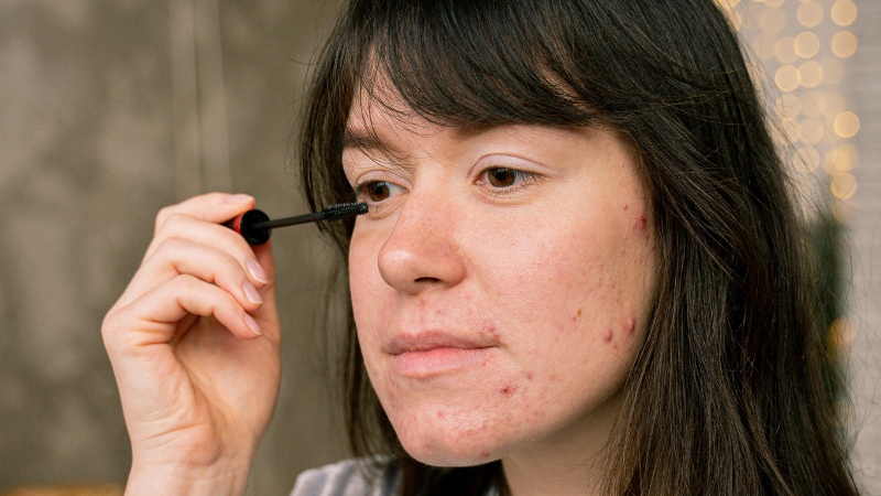Eine Frau mit Akne im Gesicht tuscht ihre Wimpern.